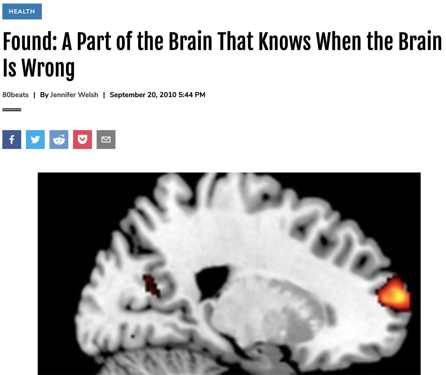 Found: A Part of the Brain That Knows When the Brain Is Wrong