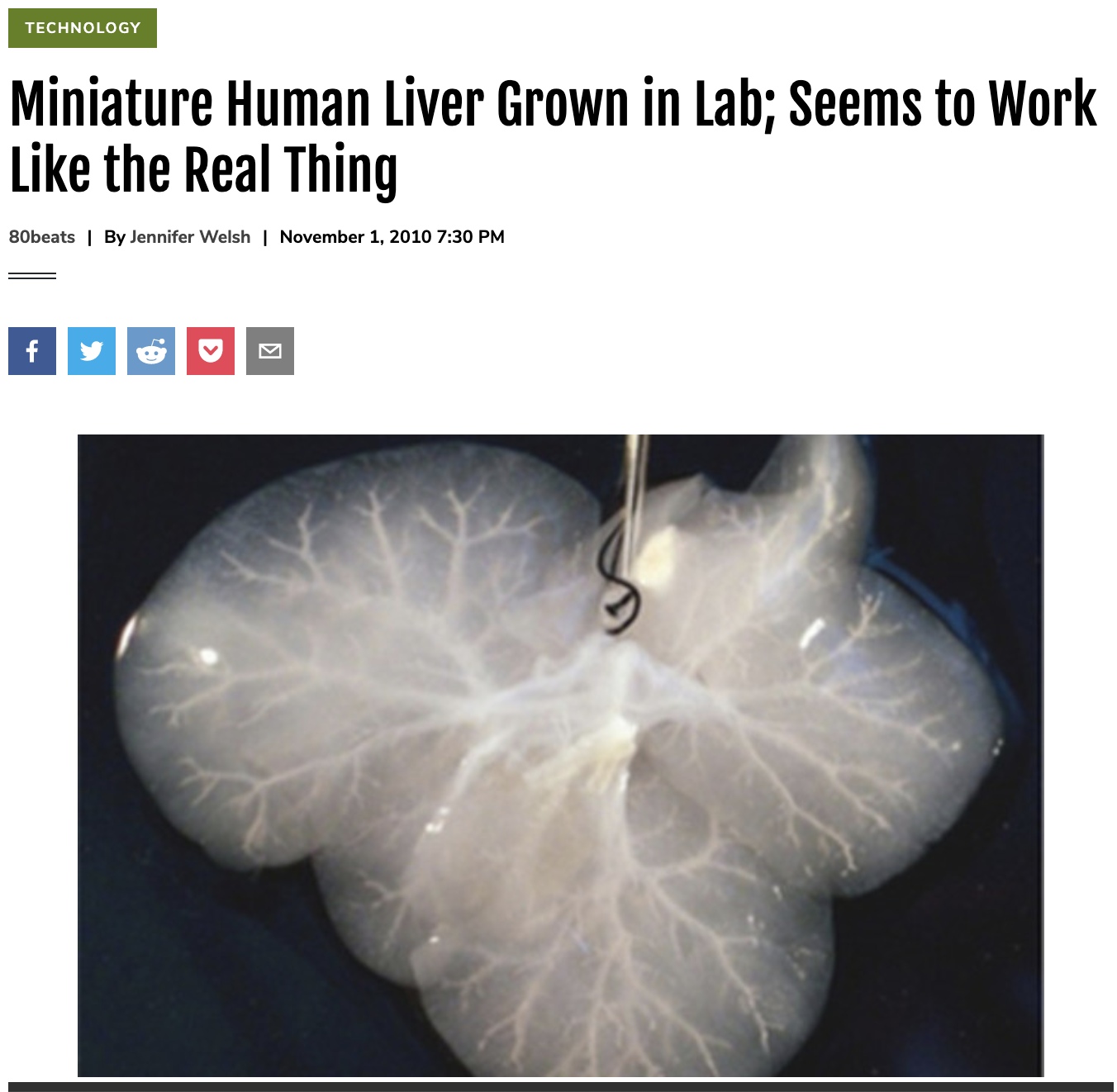 Miniature Human Liver Grown in Lab; Seems to Work Like the Real Thing